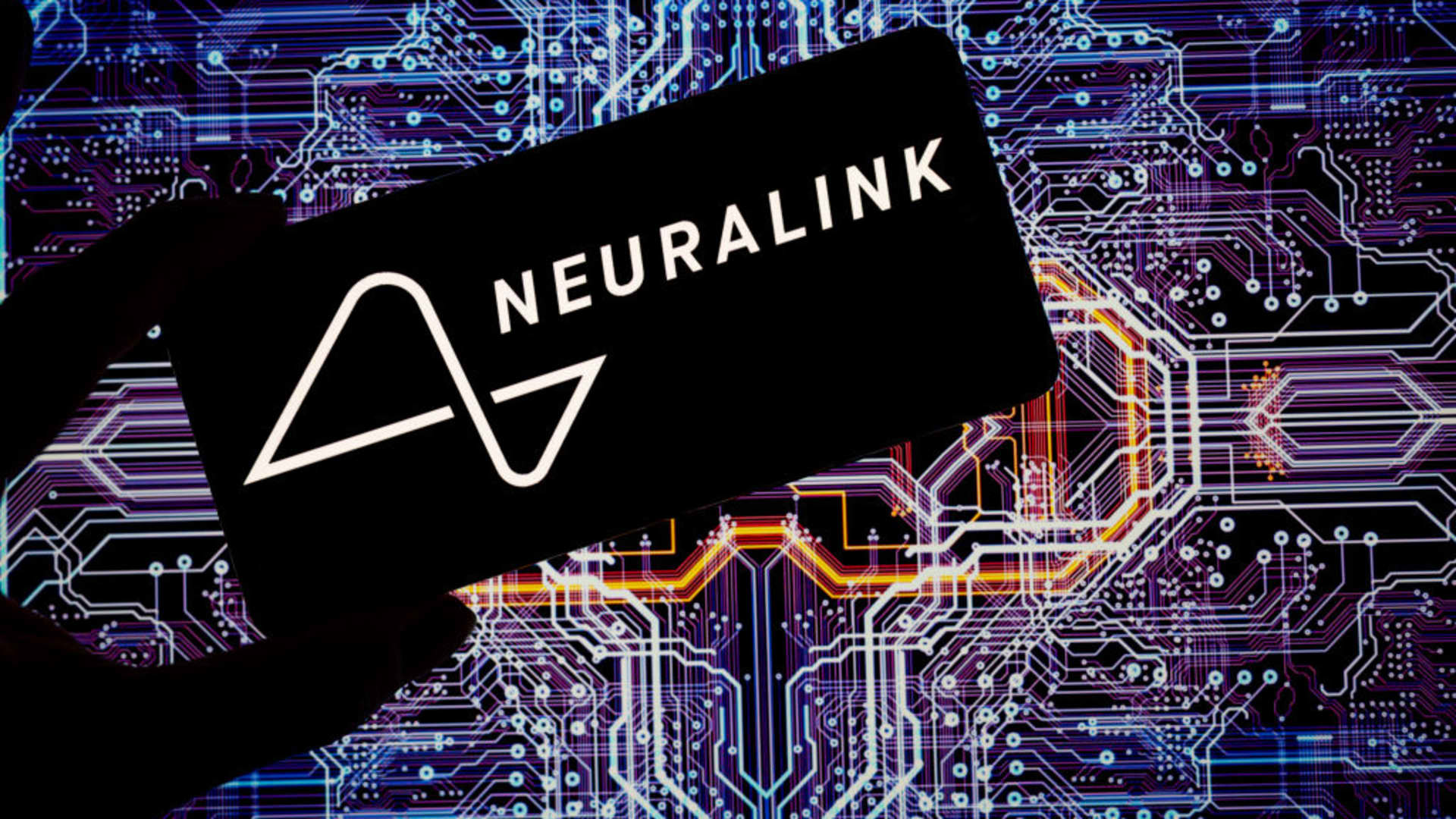 Neuralink公司表示，其首个人脑植入物出现了问题